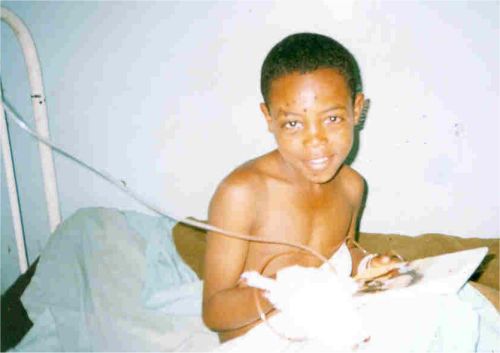 boy recovering from an operation in Gondar Hospital (he lost a thumb and fingers after playing with a hand grenade left over from the civil war) - Kate gave him a book to read