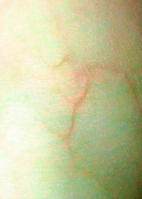 Silo�n�s arm 
[digital print 2008, edition of 1]

