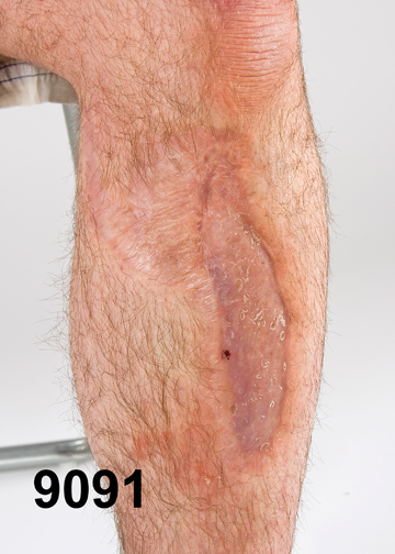 PERSONAL INJURY PHOTOGRAPHY