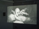Caesarean Section